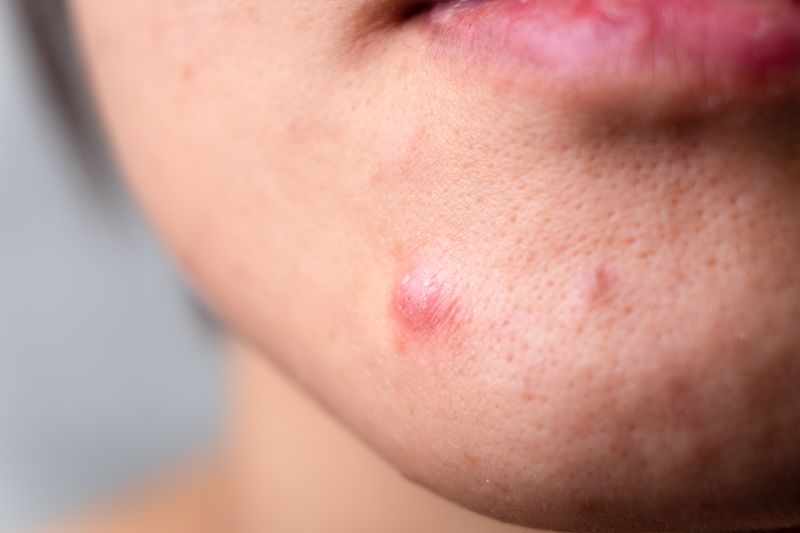 close up of a person s skin