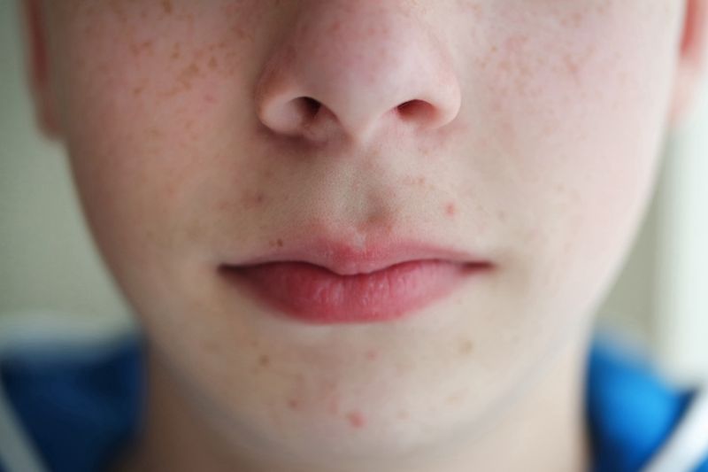close up of the young teenage skin nose and lips