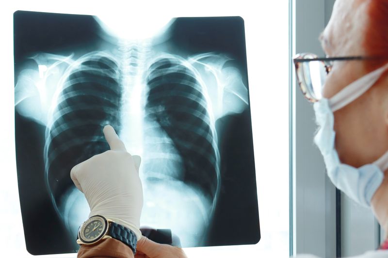 doctor examining a chest x ray in medical office