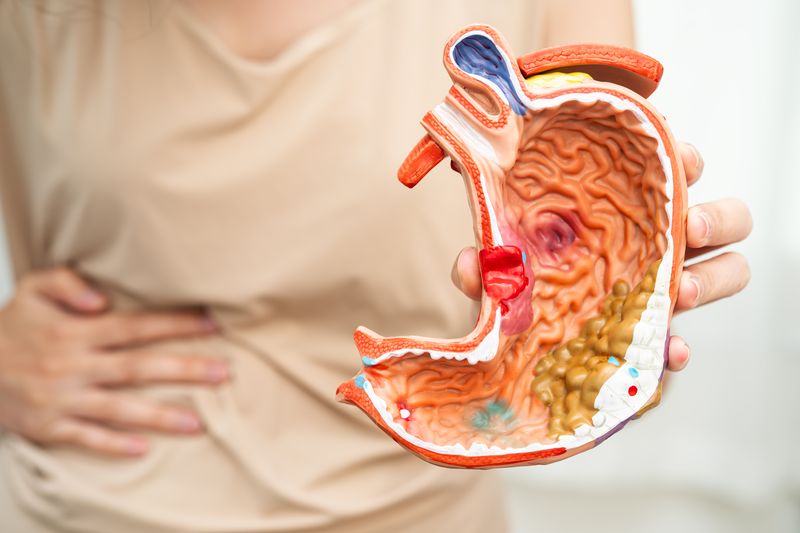 stomach disease asian woman holding anatomy model